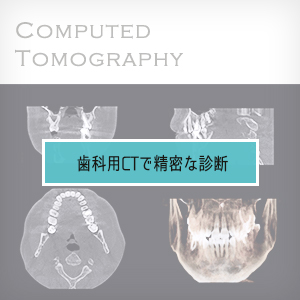 歯科用CTで精密な診断